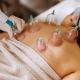 cupping therapy treatment newmarket